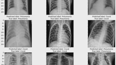 Detecting coronavirus from chest X-rays using transfer learning featured image